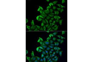 Immunofluorescence analysis of A549 cells using FABP5 antibody. (FABP5 anticorps  (AA 1-135))