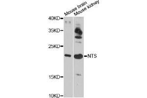 Western blot analysis of extracts of various cell lines, using NTS antibody (ABIN5998396) at 1:3000 dilution.