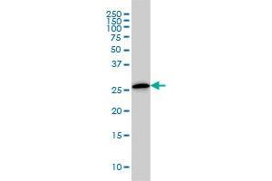 CLIC3 monoclonal antibody (M02), clone 3F8 Western Blot analysis of CLIC3 expression in A-431 .