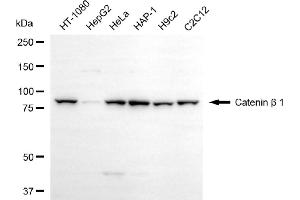 Western blotting analysis using catenin beta 1 antibody (ABIN7797931).