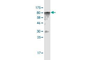 Western Blot detection against Immunogen (82. (CAMKK1 anticorps  (AA 1-520))