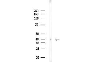Western blot analysis of lysates from Rat lung, using EGLN2 Antibody at 1/1000 dilution.