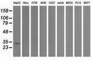 Image no. 1 for anti-Peroxisomal Trans-2-Enoyl-CoA Reductase (PECR) antibody (ABIN1500149) (PECR anticorps)