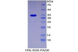 SDS-PAGE analysis of Mouse Multidrug Resistance-Associated Protein 1 Protein. (ABCC1 Protéine)