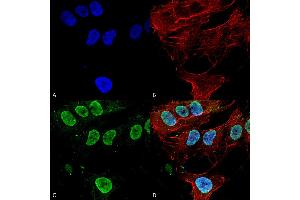 Immunocytochemistry/Immunofluorescence analysis using Mouse Anti-Cav3. (CACNA1G anticorps  (AA 2052-2172) (HRP))