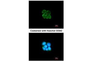 ICC/IF Image Immunofluorescence analysis of methanol-fixed A431, using SERPINF2, antibody at 1:200 dilution.