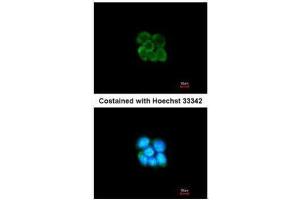ICC/IF Image Immunofluorescence analysis of methanol-fixed A431, using SERPINF2, antibody at 1:200 dilution. (alpha 2 Antiplasmin anticorps  (Center))