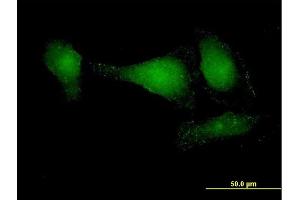 Immunofluorescence of purified MaxPab antibody to APPL2 on HeLa cell. (APPL2 anticorps  (AA 1-664))