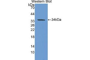 Western blot analysis of the recombinant protein. (CA5B anticorps  (AA 34-317))