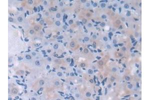 Detection of LDLRAP1 in Mouse Ovary Tissue using Polyclonal Antibody to Low Density Lipoprotein Receptor Adaptor Protein 1 (LDLRAP1)