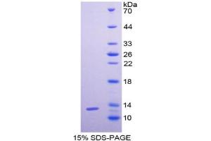 SDS-PAGE analysis of Human GCP2 Protein. (GCP2 Protéine)