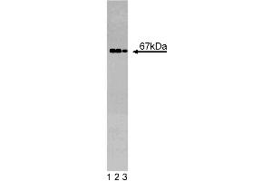 Western blot analysis of GGA2 on a EB-1 cell lysate (Human B lymphoblast, Burkitt's lymphoma, ATCC HTB-60). (GGA2 anticorps  (AA 334-445))