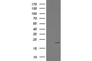 Image no. 9 for anti-ADP-Ribosylation Factor-Like 2 Binding Protein (ARL2BP) antibody (ABIN1496715)
