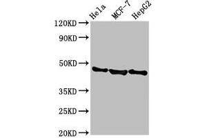 Western Blot Positive WB detected in: Hela whole cell lysate, MCF-7 whole cell lysate, HepG2 whole cell lysate All lanes: BFSP2 antibody at 3. (BFSP2 anticorps  (AA 11-110))