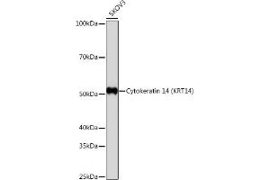 Western blot analysis of extracts of SKOV3 cells, using Cytokeratin 14 (KRT14) (KRT14) antibody (ABIN7268091) at 1:1000 dilution. (KRT14 anticorps)
