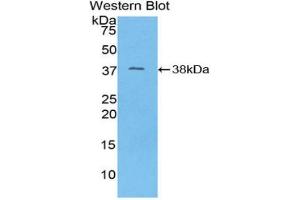 Western blot analysis of the recombinant protein. (MT-ND1 anticorps  (AA 122-171))