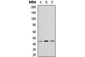 Western blot analysis of GPR13 expression in MCF7 (A), NS-1 (B), PC12 (C) whole cell lysates. (CX3CR1 anticorps  (C-Term))