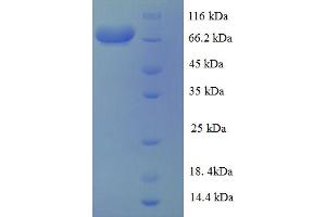 SDS-PAGE (SDS) image for V-Akt Murine Thymoma Viral Oncogene Homolog 1 (AKT1) (AA 1-480), (full length) protein (GST tag) (ABIN5712998)