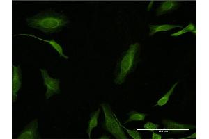 Immunofluorescence of monoclonal antibody to PCNA on HeLa cell.