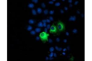 Image no. 4 for anti-Protein Phosphatase, Mg2+/Mn2+ Dependent, 1B (PPM1B) antibody (ABIN1500371)