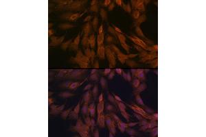 Immunofluorescence analysis of C6 cells using ULK3 Rabbit mAb (ABIN7271222) at dilution of 1:100 (40x lens). (ULK3 anticorps)