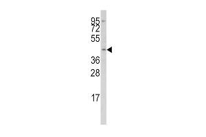 Western blot analysis of anti-IRF8 Antibody in Jurkat cell line lysates (35ug/lane) (IRF8 anticorps  (AA 241-269))
