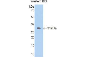 Western blot analysis of the recombinant protein. (CRP anticorps  (AA 20-225))