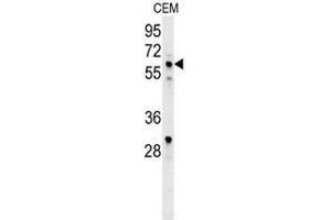 Western blot analysis in CEM cell line lysates (35ug/lane) using IKZF1/IKAROS Antibody (C-term). (IKZF1 anticorps  (C-Term))