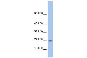 NDP antibody used at 1 ug/ml to detect target protein. (Norrie Disease (Pseudoglioma) anticorps)