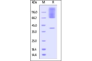 Mouse Glypican 3, His Tag on  under reducing (R) condition.