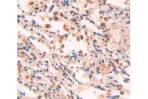 Figure. (TSC22D1 anticorps  (AA 803-1070))