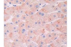 DAB staining on IHC-P; Samples: Human Liver Tissue (LGALS9B anticorps  (AA 17-148))