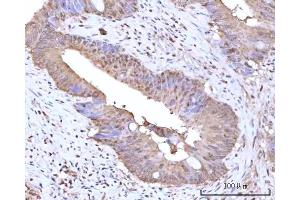 IHC analysis of RNGTT using anti-RNGTT antibody (ABIN7599723).