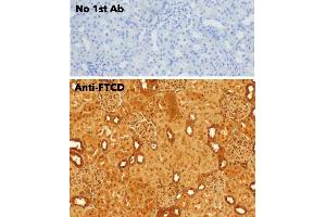 Immunohistochemistry (IHC) image for anti-Formiminotransferase Cyclodeaminase (FTCD) (N-Term) antibody (ABIN6254252)