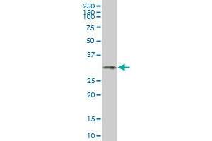 HOXC4 monoclonal antibody (M02), clone 2D6 Western Blot analysis of HOXC4 expression in K-562 .
