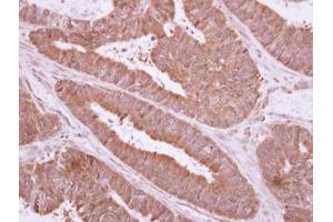 Image no. 1 for anti-NME Gene Family Member 9 (NME9) (AA 1-142) antibody (ABIN1501588)