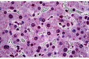 Human Liver: Formalin-Fixed, Paraffin-Embedded (FFPE) (SGK1 anticorps  (AA 1-91))