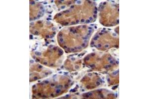 Immunohistochemistry analysis in formalin fixed and paraffin embedded human stomach tissue reacted with LRWD1 Antibody (N-term) followed which was peroxidase conjugated to the secondary antibody and followed by DAB staining. (LRWD1 anticorps  (N-Term))