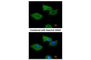 ICC/IF Image Immunofluorescence analysis of methanol-fixed A549, using RGS2, antibody at 1:200 dilution. (RGS2 anticorps)