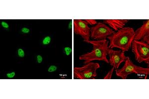 ICC/IF Image ZHX2 antibody [C1C3] detects ZHX2 protein at nucleus by immunofluorescent analysis. (ZHX2 anticorps  (C-Term))