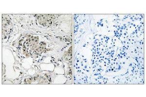 Immunohistochemistry (IHC) image for anti-Ubiquitin Specific Peptidase 13 (Isopeptidase T-3) (USP13) (C-Term) antibody (ABIN1852328) (USP13 anticorps  (C-Term))