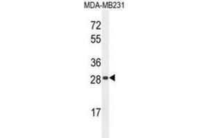 Western Blotting (WB) image for anti-Haptoglobin Related Protein (HPR) antibody (ABIN2996022) (HPR anticorps)