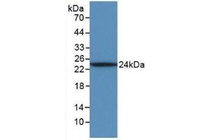 Detection of Recombinant IL6, Ovine using Monoclonal Antibody to Interleukin 6 (IL6)