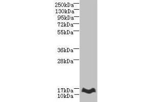 Western blot All lanes: MTHFD2L antibody at 6 μg/mL + Mouse lung tissue Secondary Goat polyclonal to rabbit IgG at 1/10000 dilution Predicted band size: 38, 32, 8, 25, 33 kDa Observed band size: 14 kDa (MTHFD2L anticorps  (AA 136-268))