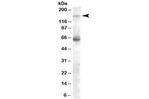Western blot testing of human skeletal muscle lysate with NOS1 antibody at 0. (NOS1 anticorps)