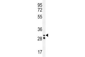 Neutrophil elastase antibody western blot analysis in A2058 lysate.