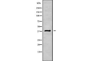 Western blot analysis of MAGB3 using HUVEC whole cell lysates