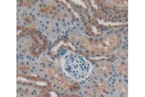 Used in DAB staining on fromalin fixed paraffin- embedded Kidney tissue