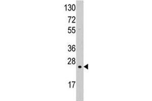 Western blot analysis of SOD2 antibody and K562 lysate.