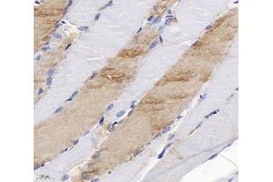 Immunohistochemistry analysis of paraffin-embedded rat skeletal muscle using SLC6A8 (ABIN7075678) at dilution of 1: 400 (SLC6A8 anticorps)